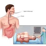 Endoscopy