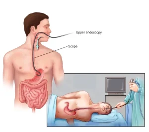 Endoscopy