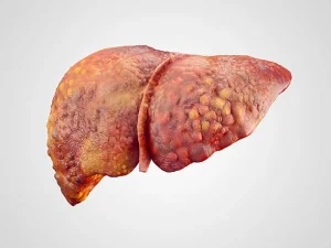 Liver Disease Consulation